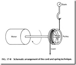 Schematic arrangement of the cord and spring technique