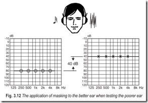 Fig. 3.12 The application of masking to the better ear when testing the poorer ear