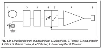 Fig. 3.14 Simplified diagram of a hearing aid  1. Microphone, 2. Telecoil, 3. Input amplifier,  4. F
